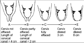 Can i check my cervix for dilation