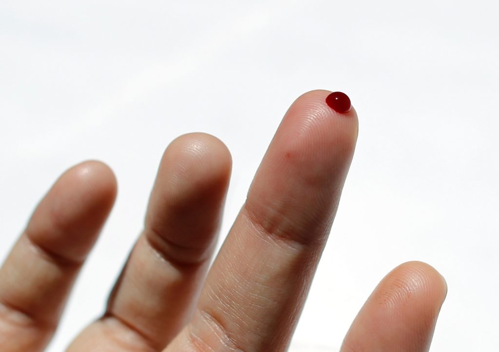 Bleeding under finger nails - Stock Image - M330/1277 - Science Photo  Library